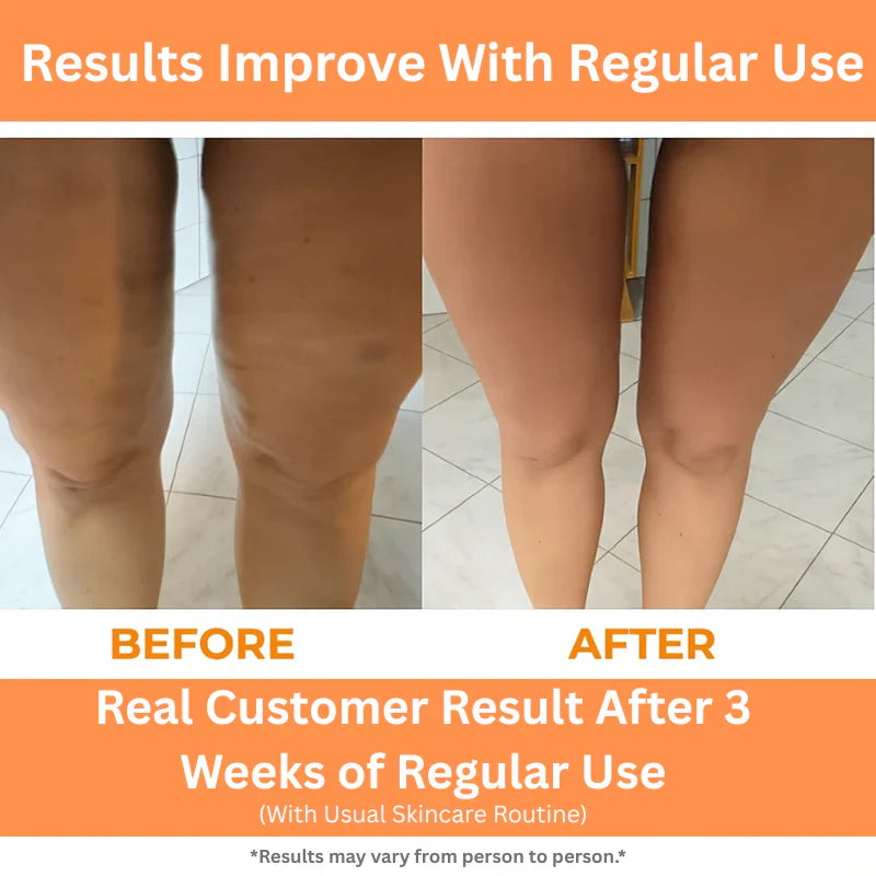 GlowTrace™ Deep Tissue Roller